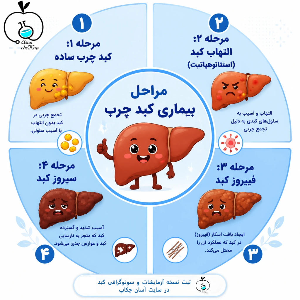 مراحل و استیج کبد چرب
